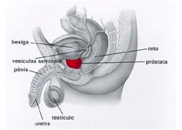 Câncer de prostata